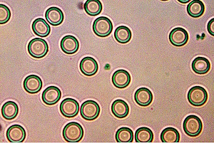 Blood, Covid & Cross Domain Bacteria (CDB) : Emerging Relationships