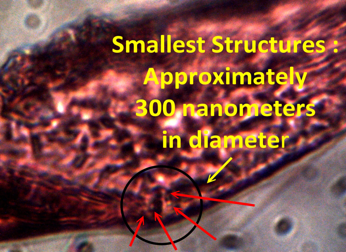 Advances in Microscopy Blood  & Skin Filament Examinations – A Slide Show